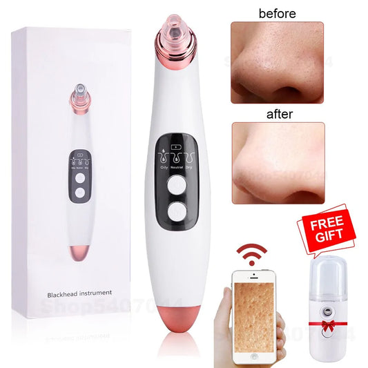 WiFi Camera Blackhead Remover Vacuum with LED Display