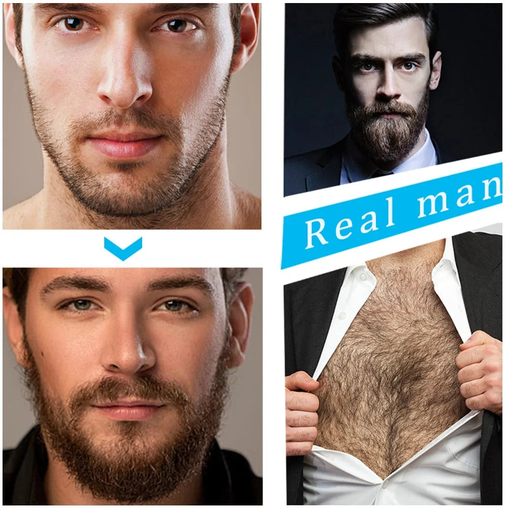 4-piece-beard-growth-kit